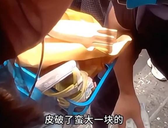 看著都疼<strong></p>
<p>西鳳酒
</strong>！上海街頭一男子突然求助：10歲女兒被死死卡??！這個(gè)行為太危險(xiǎn)→:西鳳酒
