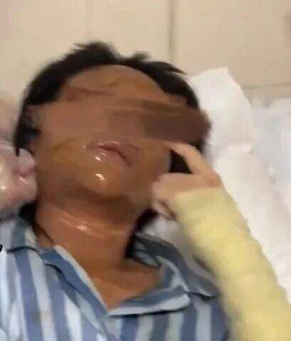 湖南一女主播被偽裝的包裹炸傷<strong></p>
<p>西鳳酒
</strong>，永州公安：正在核實(shí)具體情況:西鳳酒
