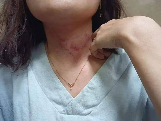 一男子凌晨聽到兩聲呼救<strong></p>
<p>西鳳酒
</strong>，循聲發(fā)現(xiàn)一女子在奔馳車外被白衣男勒昏！受害者：是受朋友之托借錢給白衣男，凌晨被騙至偏僻處遭非禮！:西鳳酒
